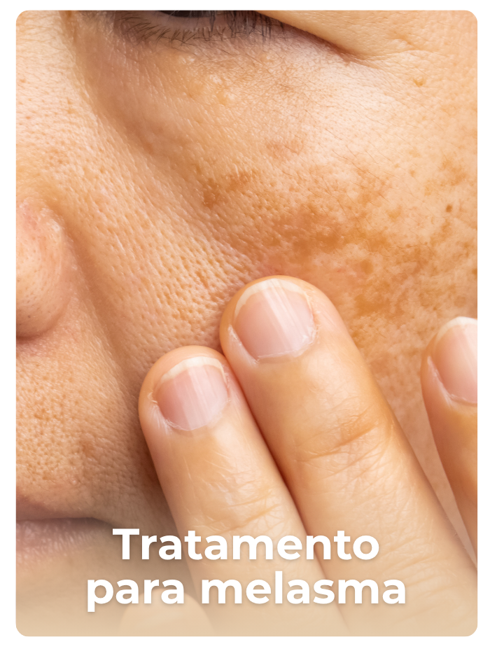 Procedimento de Skinbooster